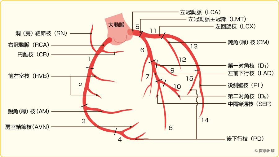 冠動脈造影 – 循環器内科.com